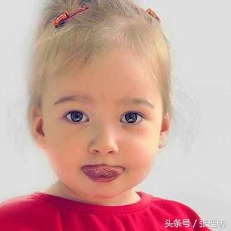 人体缺少微量元素会引起抽动症吗,抽动症有必要做个微量元素检查吗