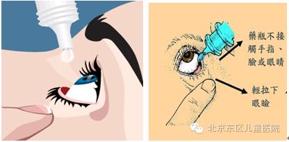 东东小卫士:如何正确使用眼药水和眼膏