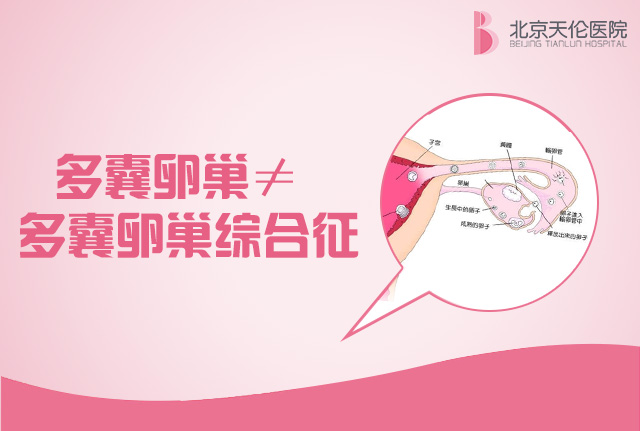 卵巢里暗藏危机？你们知道吗？