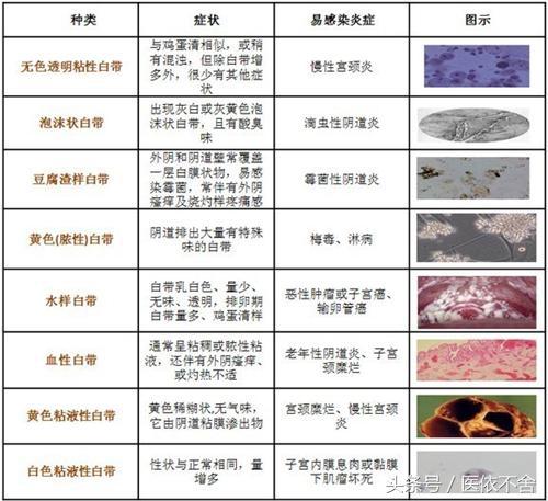 白带异常的各种表现,白带异常什么情况下出现