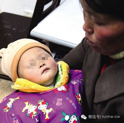 女幼童为啥会得外阴炎,女婴为什么会有外阴炎症