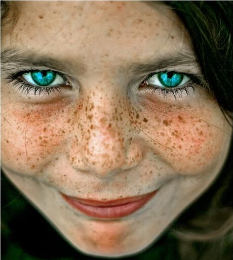 皮秒激光祛斑的副作用,激光c6祛斑副作用