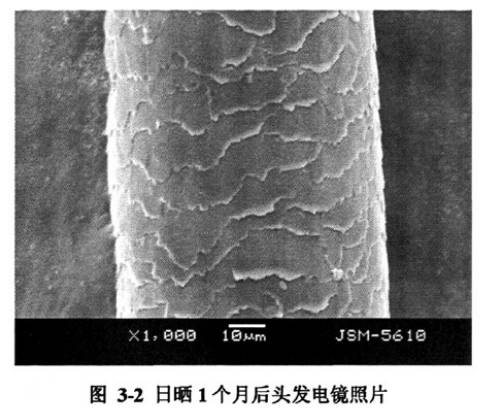 头发总分叉是缺什么营养,头发不分叉是不是营养好
