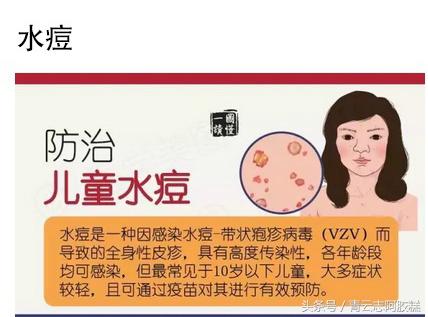 预防水痘发家长群温馨提示,水痘高发期幼儿园家长配合文案