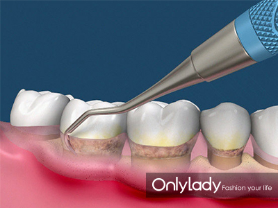 希拉里牙齿怎么样,希拉里的女儿怎么样