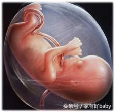 怎么样预防破水,产前如何预防妊娠纹