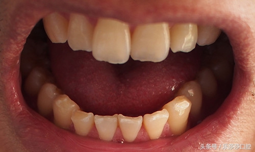 牙医能辨别出换过没换过的牙齿吗,牙医见过最好的牙齿是怎么样的