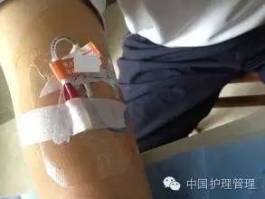 PICC日常维护应选择何种消毒剂？