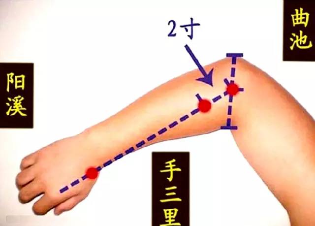 运动治愈三高,运动医学上对网球肘的康复训练