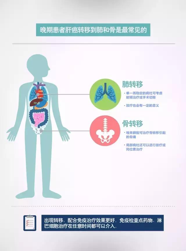 肝癌复发转移肺癌怎么治疗,肝癌复发肝内转移怎么治疗