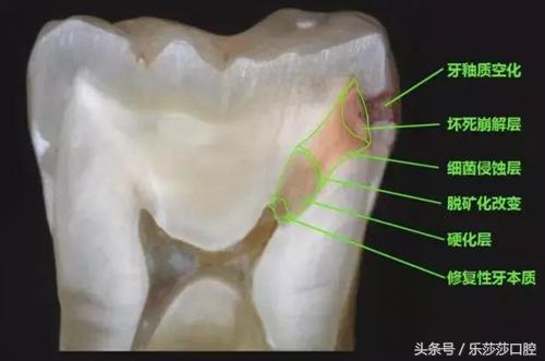 牙医能辨别出换过没换过的牙齿吗,牙医见过最好的牙齿是怎么样的