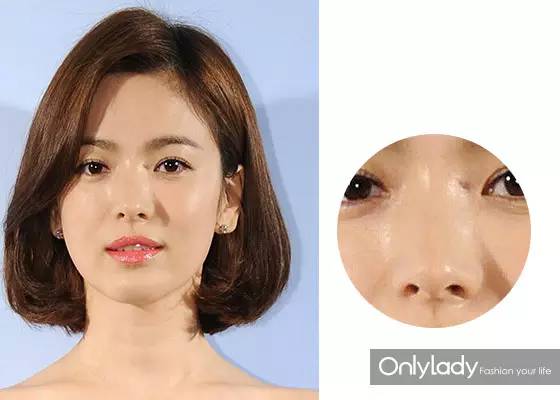 女子花4万块整容把嘴都整歪了,美国女子花76万整容