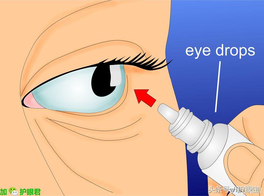 护眼小知识怎样延缓近视加深呢,眼科医生如何护眼