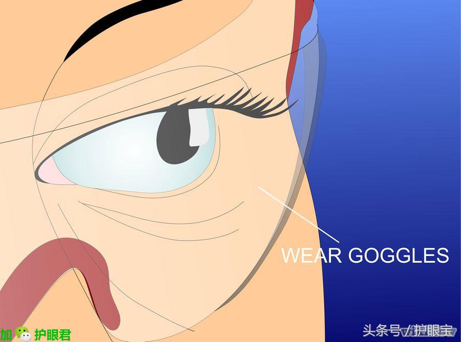 护眼小知识怎样延缓近视加深呢,眼科医生如何护眼