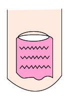 指甲出现白点与竖纹是怎么回事,指甲出现白点什么原因