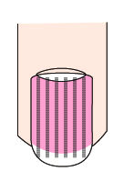 指甲出现白点、纵纹是怎么回事?