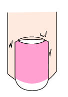 指甲竖纹里面有白点是什么原因,指甲有竖纹和白点是怎么回事