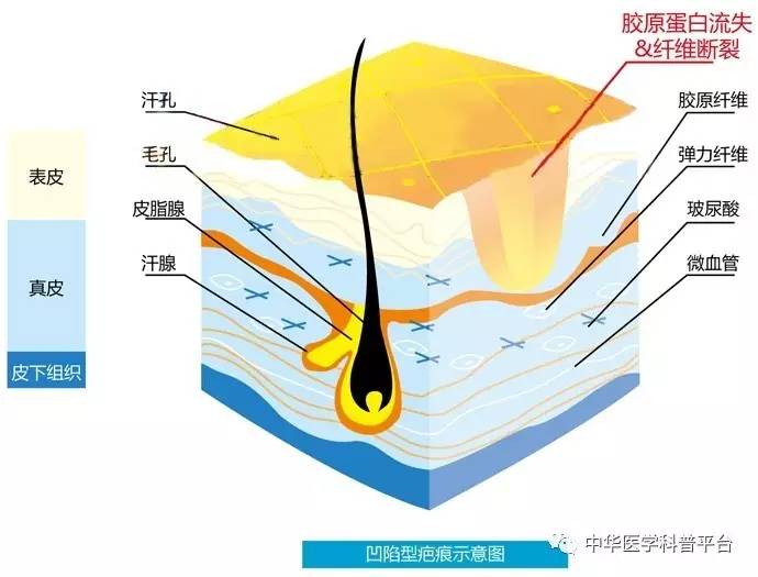 每天都在洗,皮肤这道“城墙”是怎样建成的