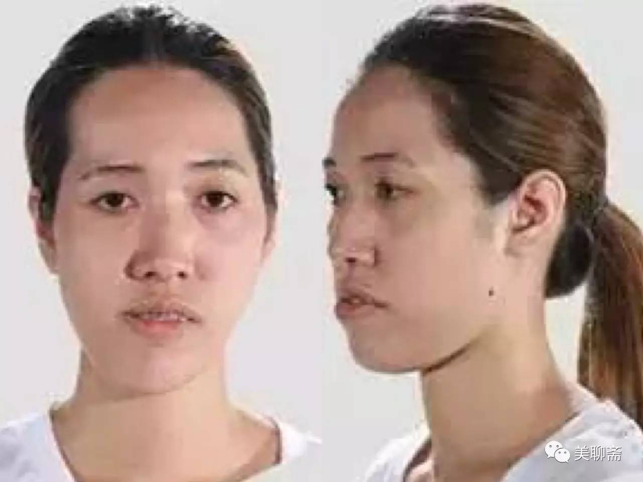 揭秘韩国整容术发达的原因,韩国整容业发达背后的原因