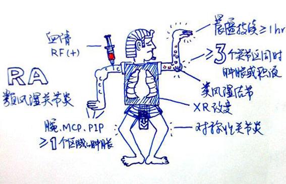 澳洲维骨力关节灵简介,维骨力治疗关节炎