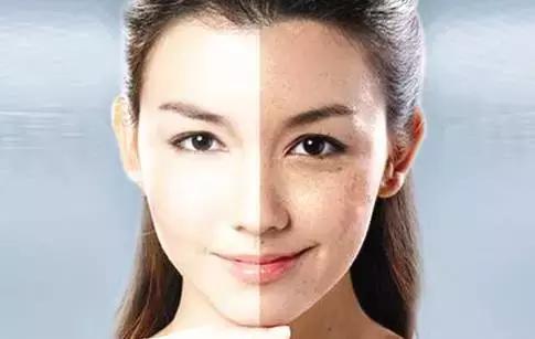 脸上长黄斑怎么检查,看脸上的斑如何知道什么病因