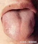 中医舌诊图谱100例,靠谱中医史上最全高清舌诊图谱