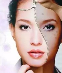 宝妈色素沉着怎么办