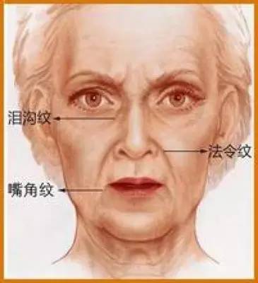 泪沟深怎么办,有了泪沟怎么补救