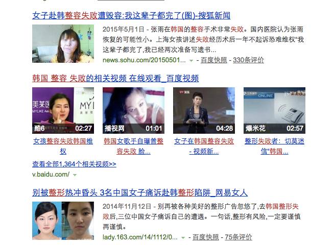 双眼皮手术韩式整形,韩国医生做幽灵手术