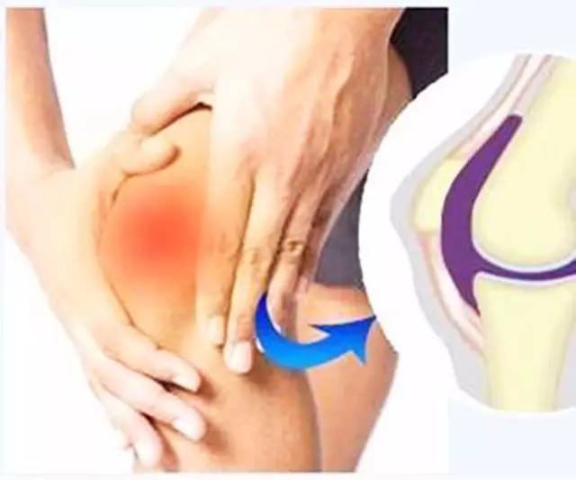 滑膜炎到底怎样才能根治,滑膜炎是一种治不好的病吗