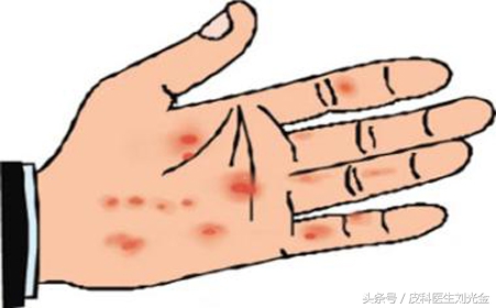 揭开谜团的真实事件,揭开皮肤病的真相