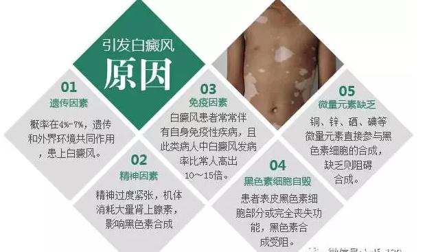 白癜风植皮治愈率是多少,白癜风怎么提高酪氨酸