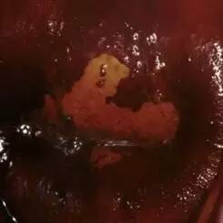 卢戈氏碘液，低身价，大用途