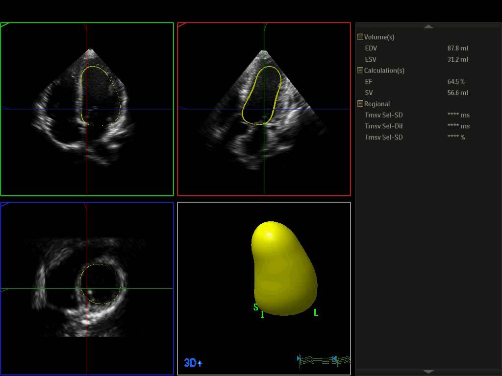 那些年我们错过的歌曲,那些年我们错过的日子