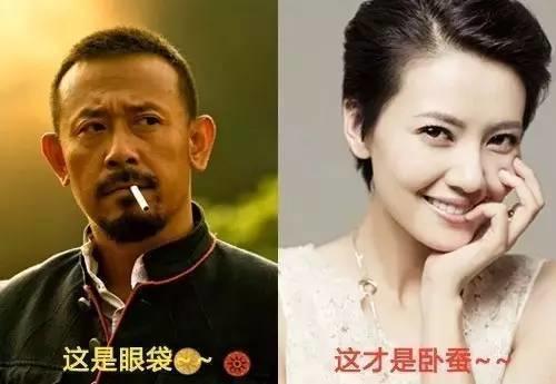 眼袋和卧蚕的区别看完你就知,卧蚕和眼袋的区别你知道吗