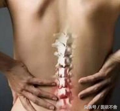 有骨刺用几个动作才能做好,如果得了骨刺该怎么办