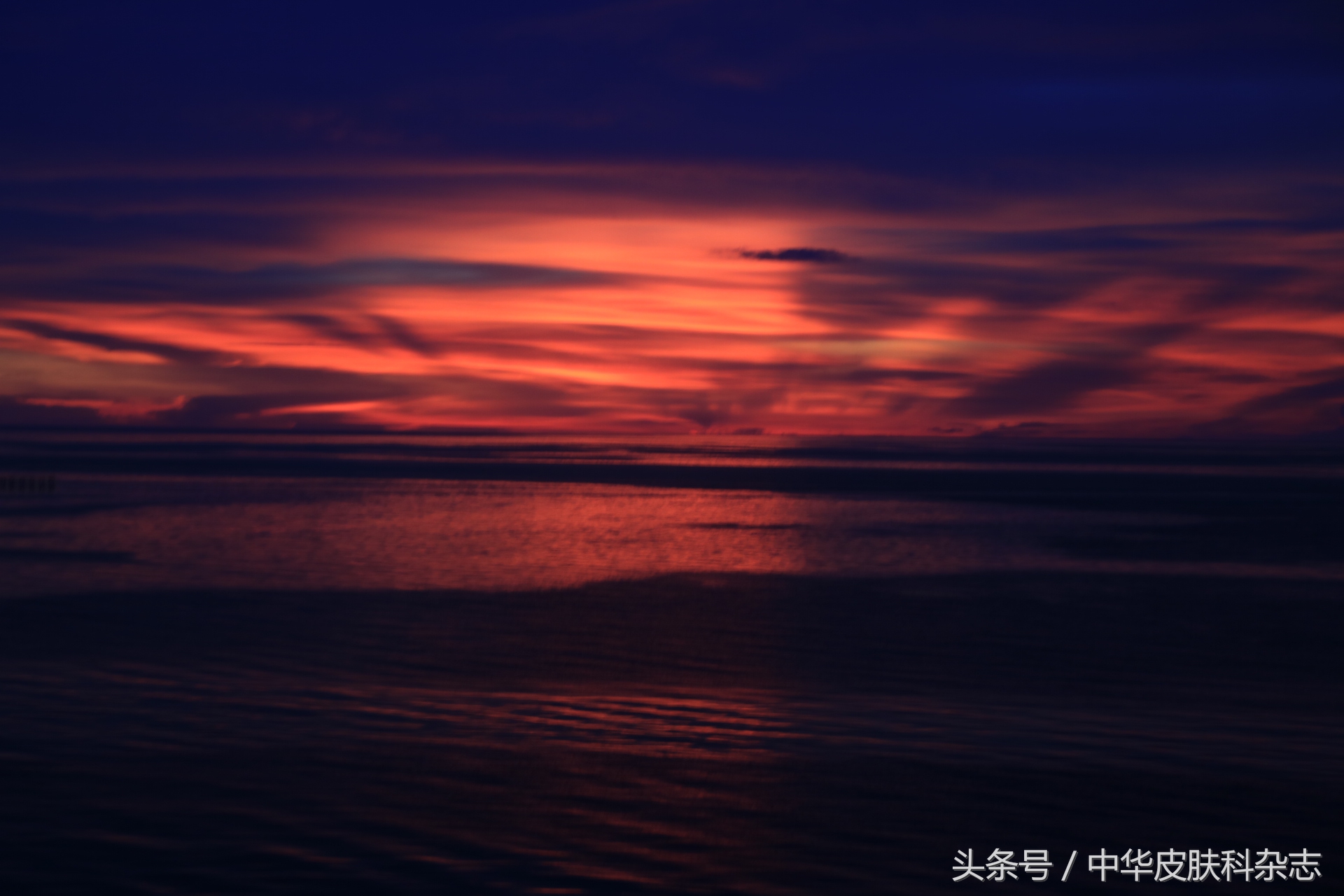 尖锐湿疣的复发与防治