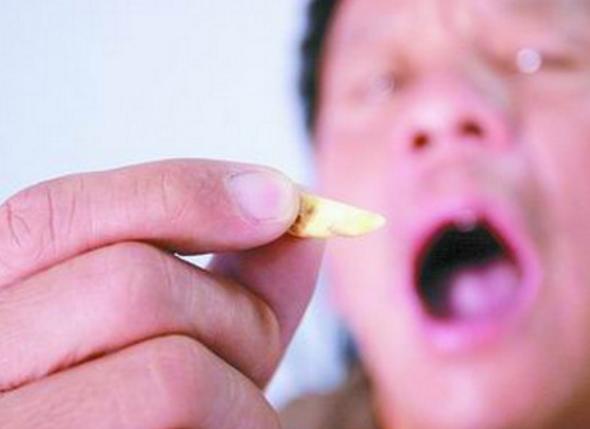 梦见自己掉牙齿是什么预兆,梦见自己掉牙齿是什么意思