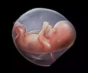 羊水塞栓究竟为何物？孕妈你知道吗？进来学习一下吧