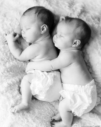 双胞胎一大一小怎么治疗,双胞胎一大一小严重吗