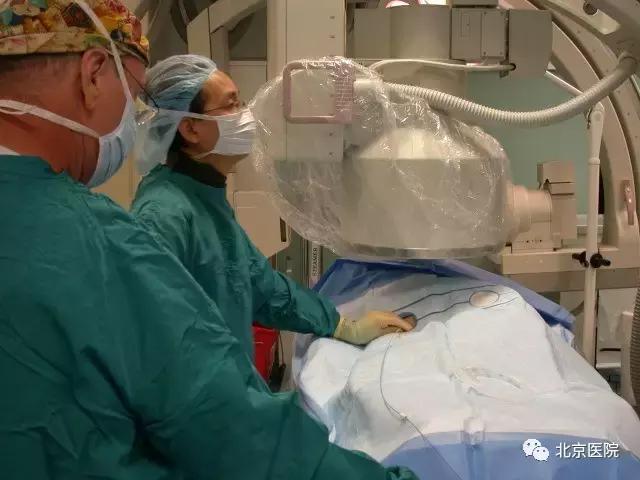 微创介入治疗肿瘤最新方案,微创介入治疗晚期癌症效果好吗