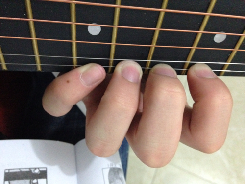 如何练吉他左手不会起茧,练吉他手指起茧会难看吗