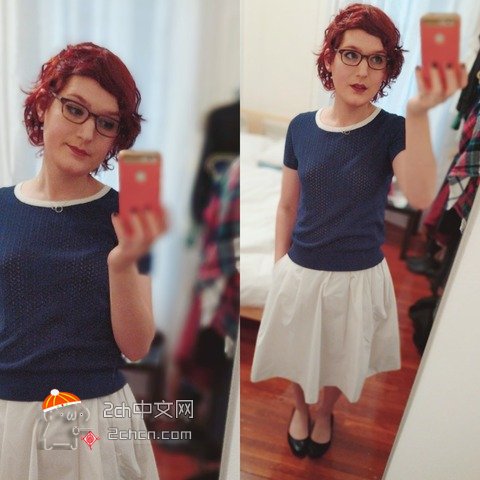 秃头大叔服用雌性激素,秃头男吃雌激素一年