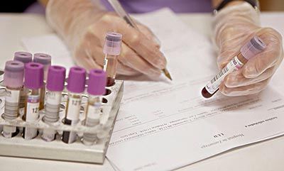 什么是溶血症?什么是ABO溶血?溶血检查些什么?给你所有答案