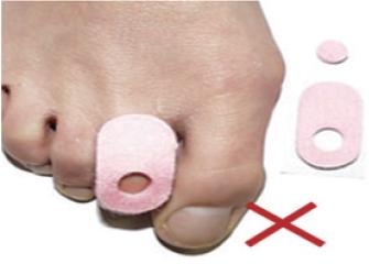 糖尿病足的预防重于治疗,糖尿病足病预防案例