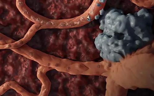 pd-1治疗淋巴瘤的效果,nk-t细胞淋巴瘤目前能治好吗