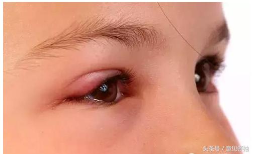 狗红眼病的症状和治疗方法,红眼病的引发原因