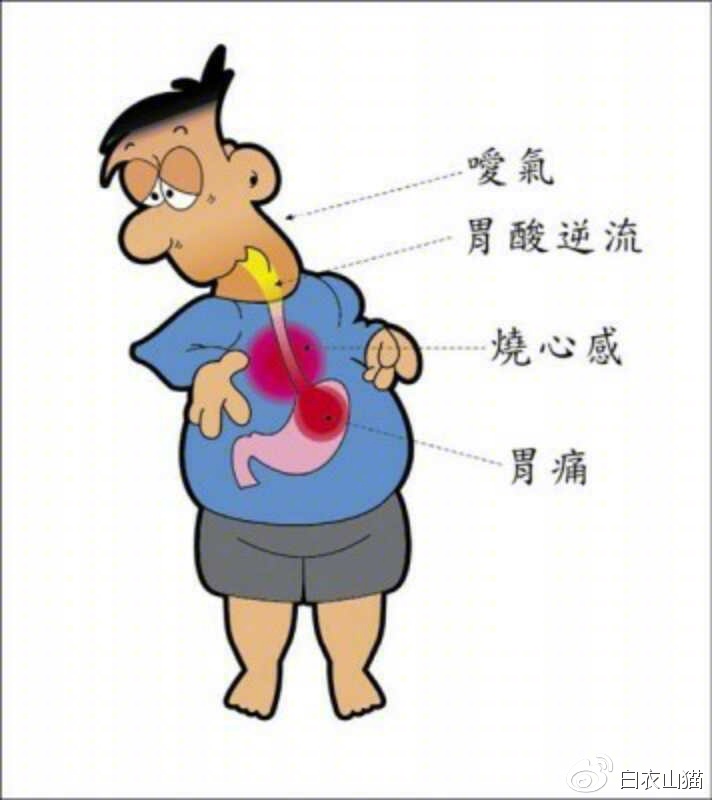 咽痛咳嗽吃消炎药没用,喉咙发炎医生让我管住嘴