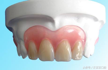 镶牙真的是一种错误吗,镶牙很假吗