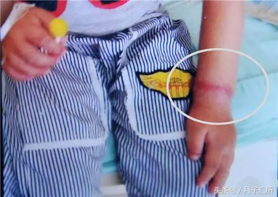 妈妈的头发，竟成宝宝“缠绕伤”的罪魁祸首！